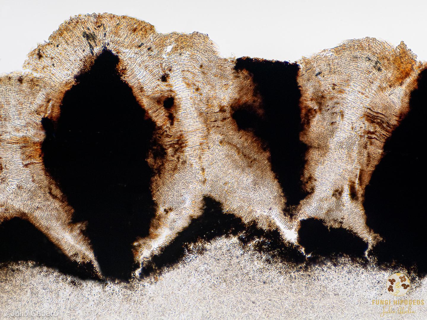 Corte transversal del exoperidio (3)