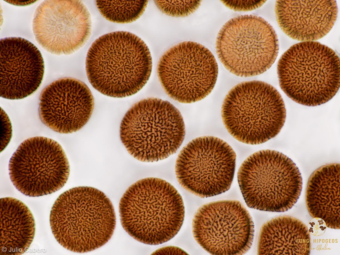 Ascosporas en relieve (6)