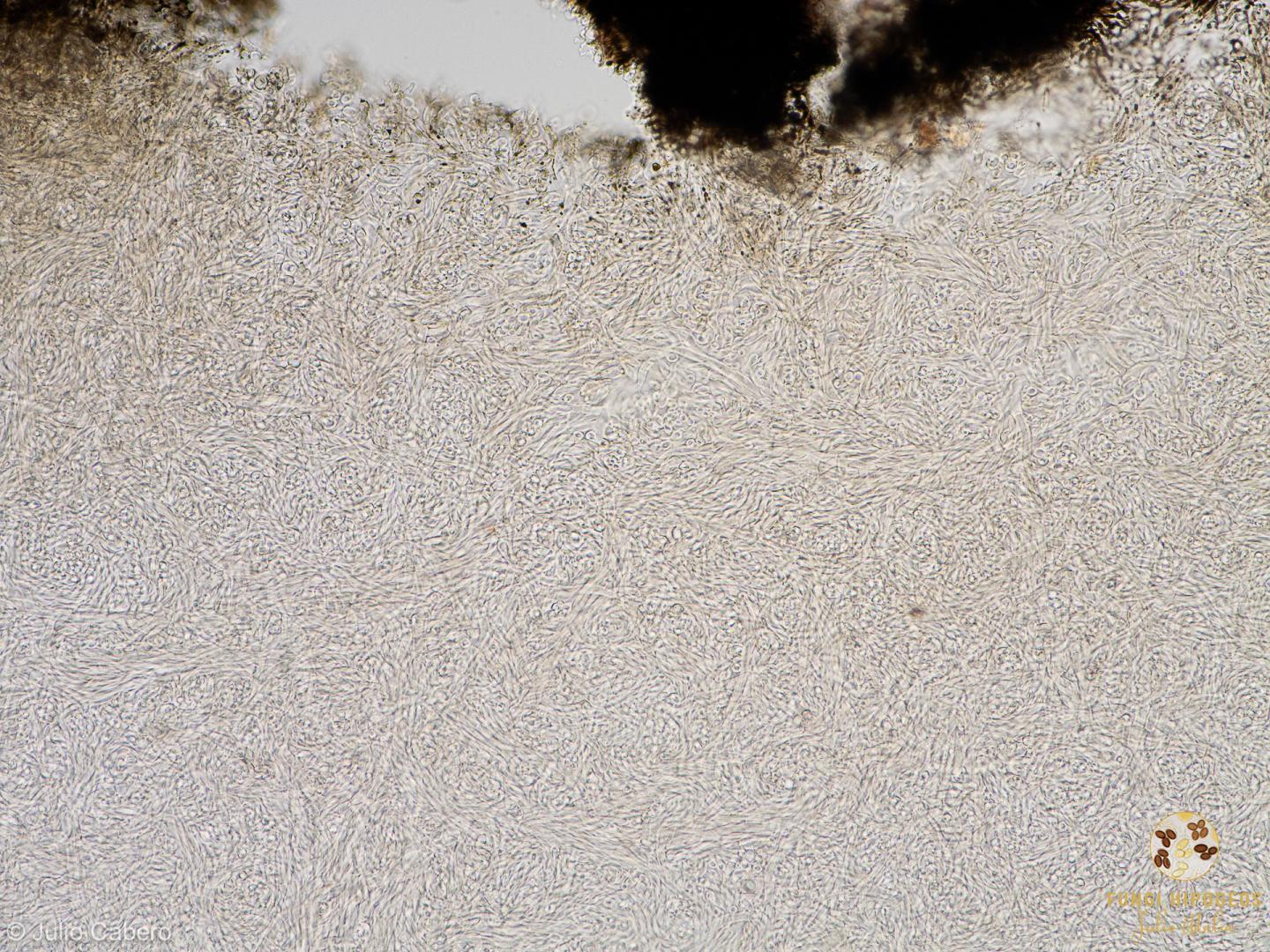 Corte transversal del endoperidio (4)