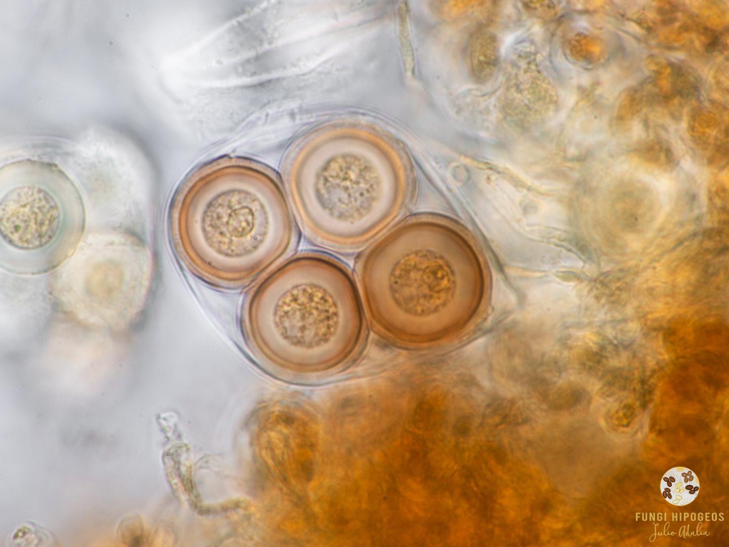 Asc&oacute;sporas inmaduras en asca 