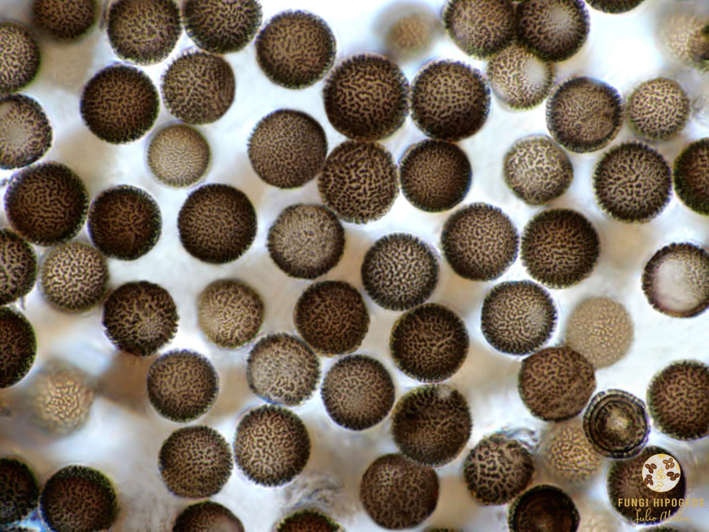 Ascosporas aculeadas 