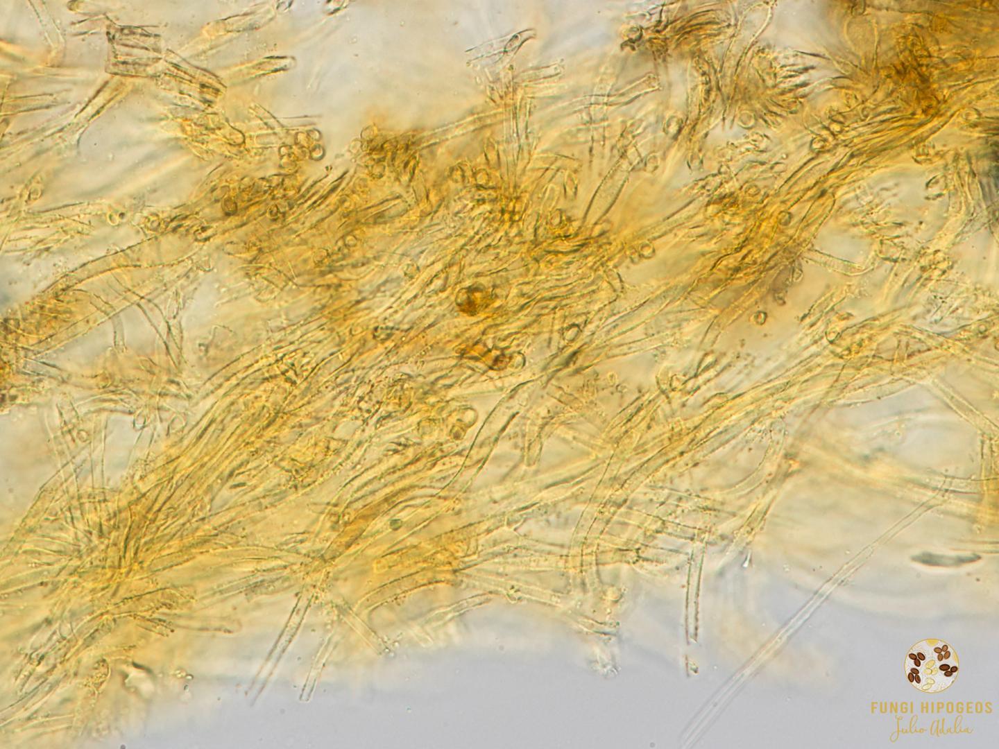 Hifas de la peridiopellis 