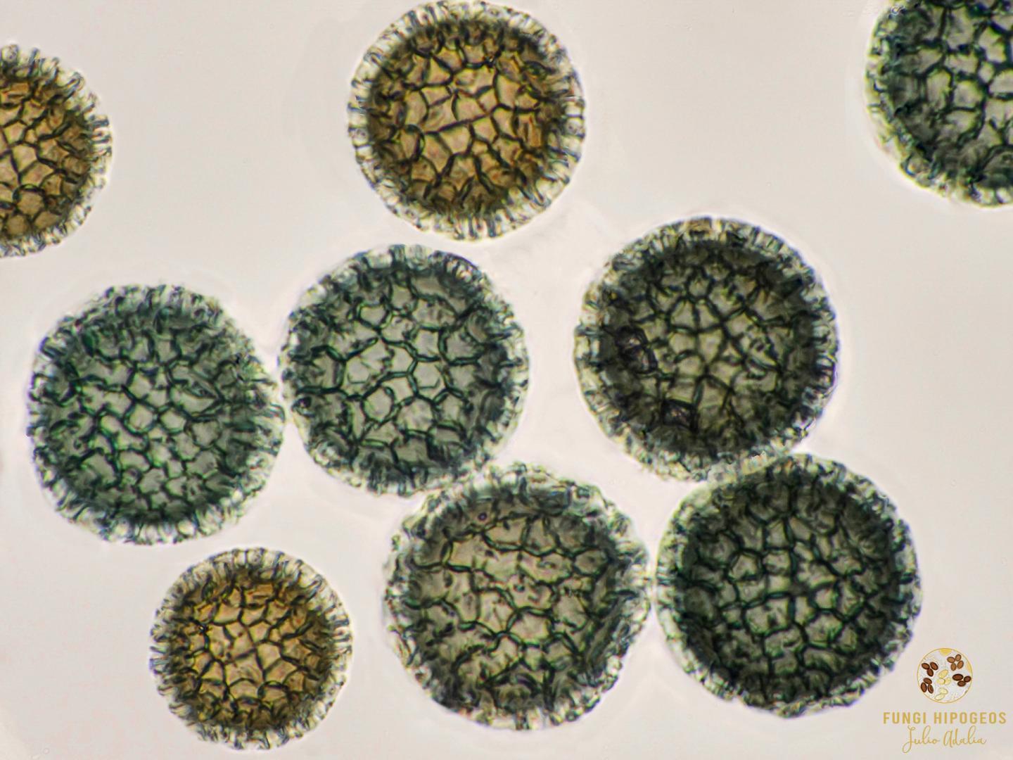 Ascosporas en relieve 100 X 