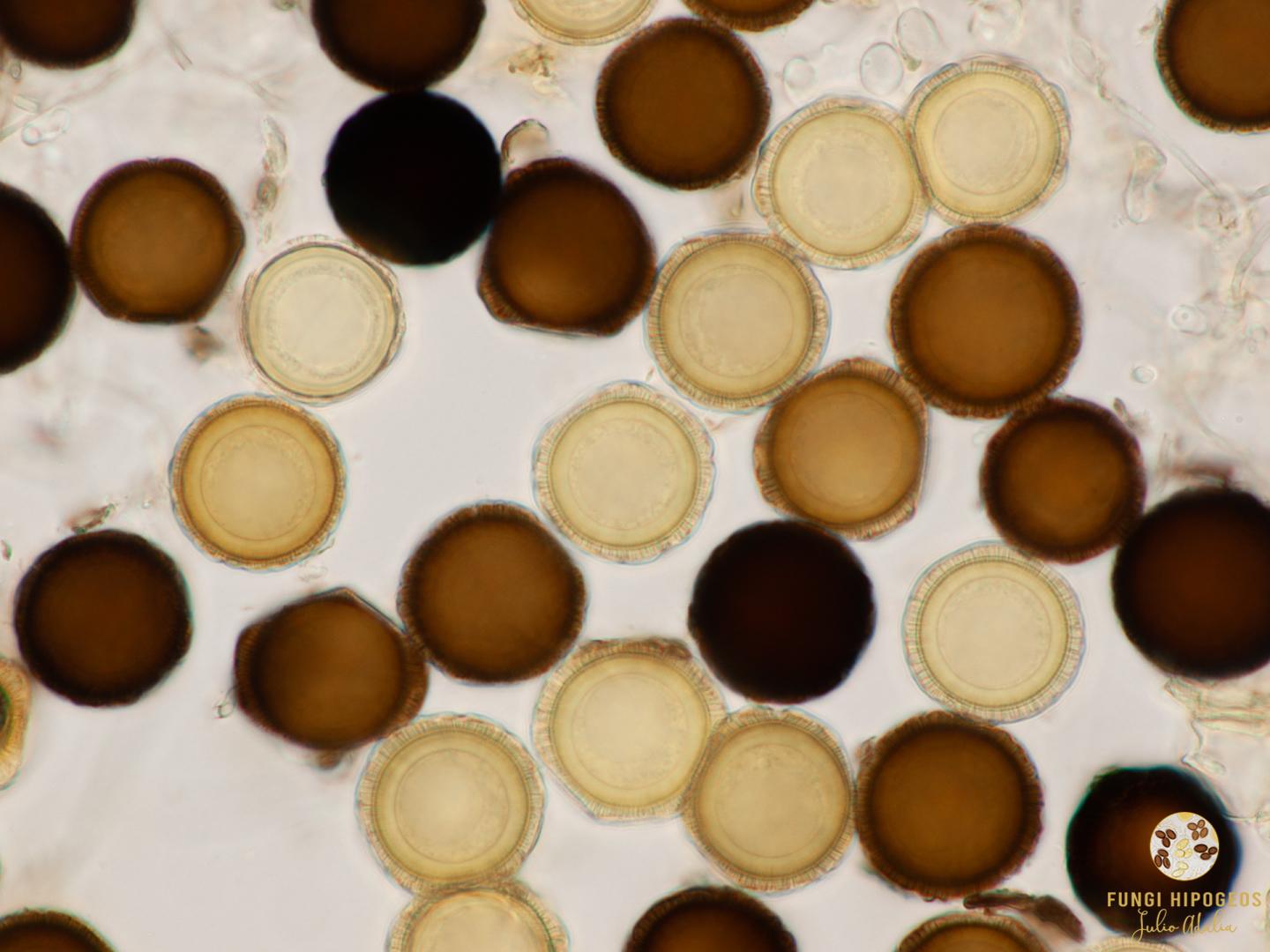 Ascosporas globosas y aculeadas 