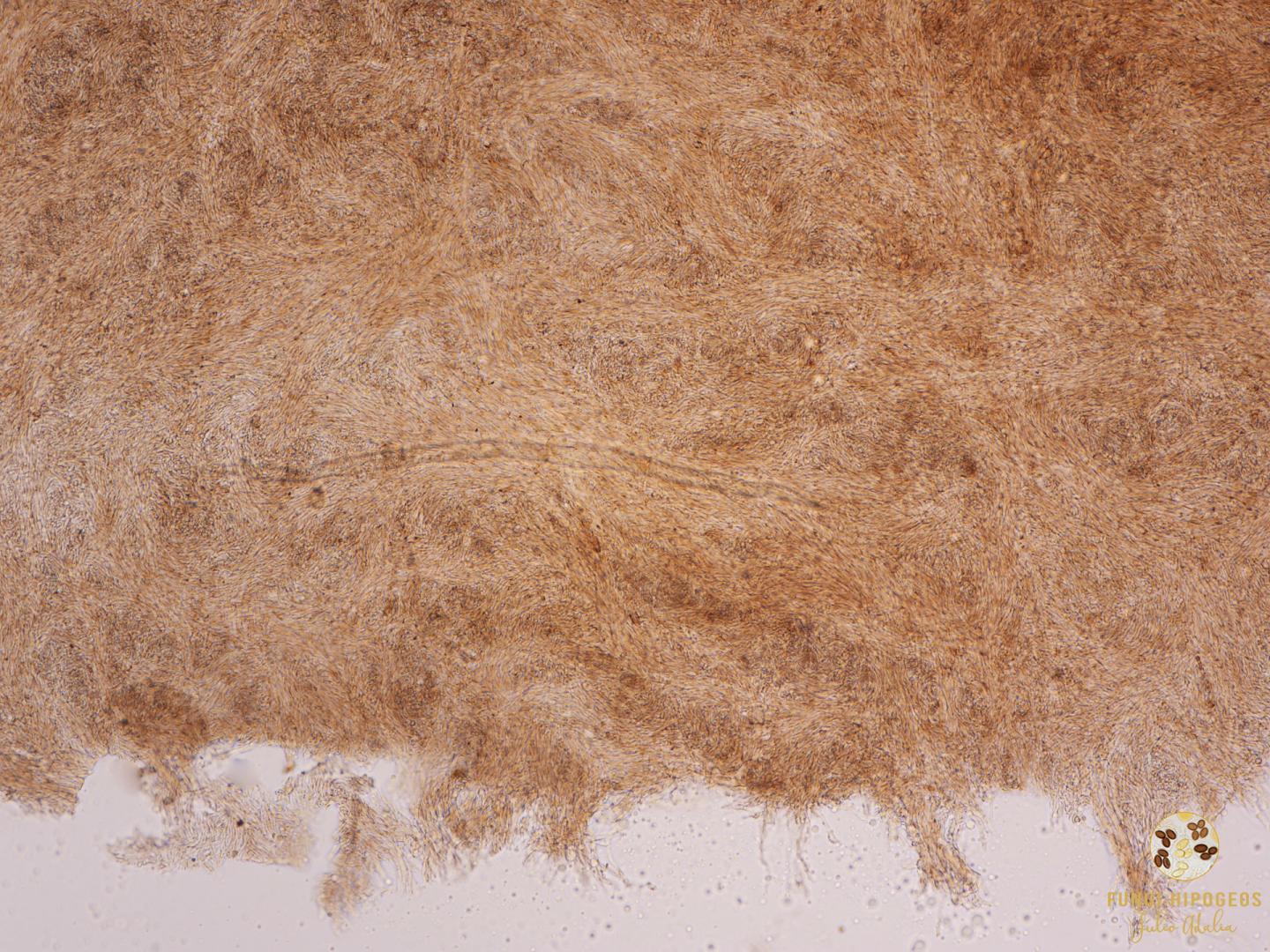 Detalle del endoperidio (Fig. 4)