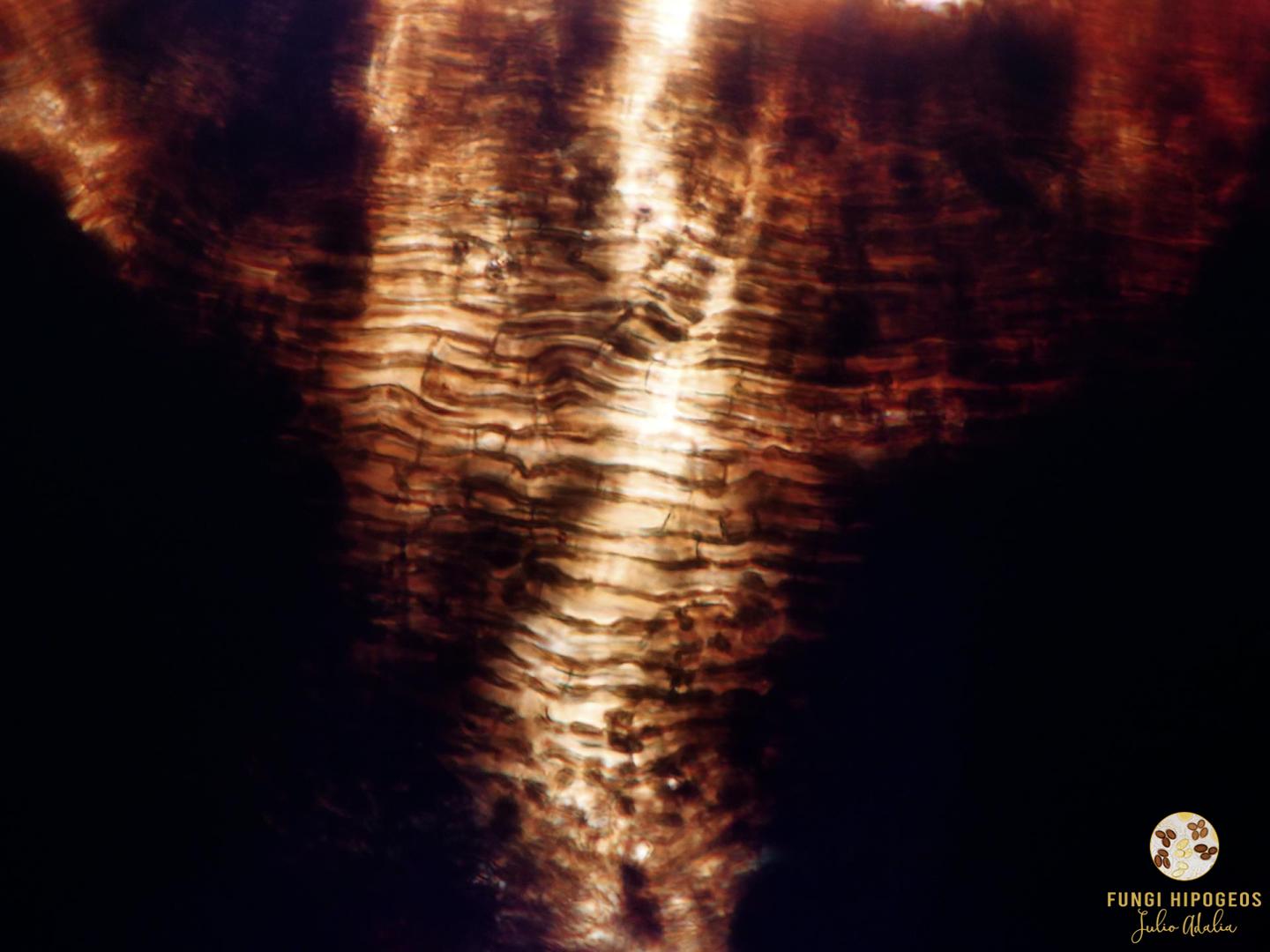 Detalle del exocortes (Fig. 5)