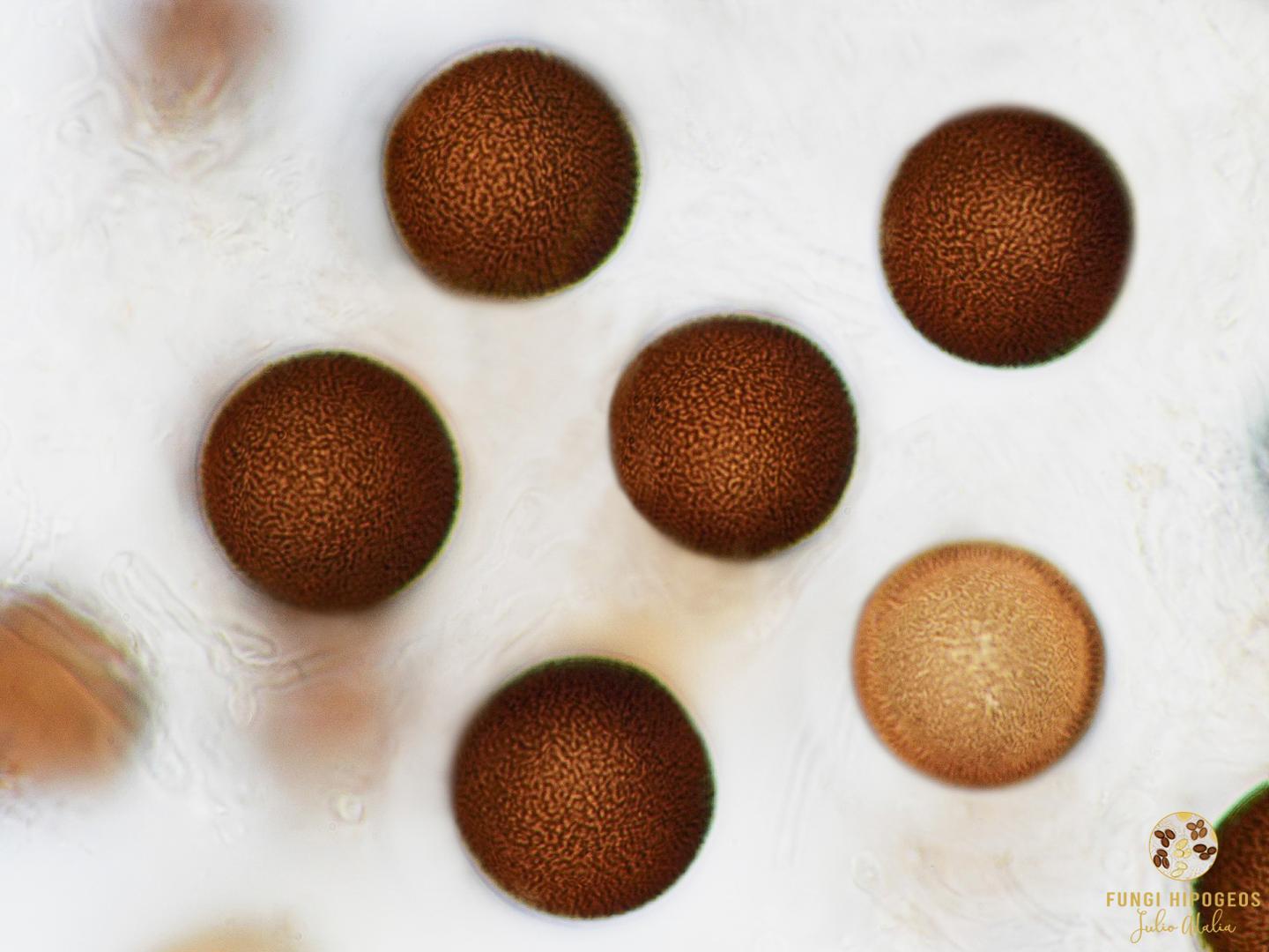 Ascosporas globosas (Fig. 6)