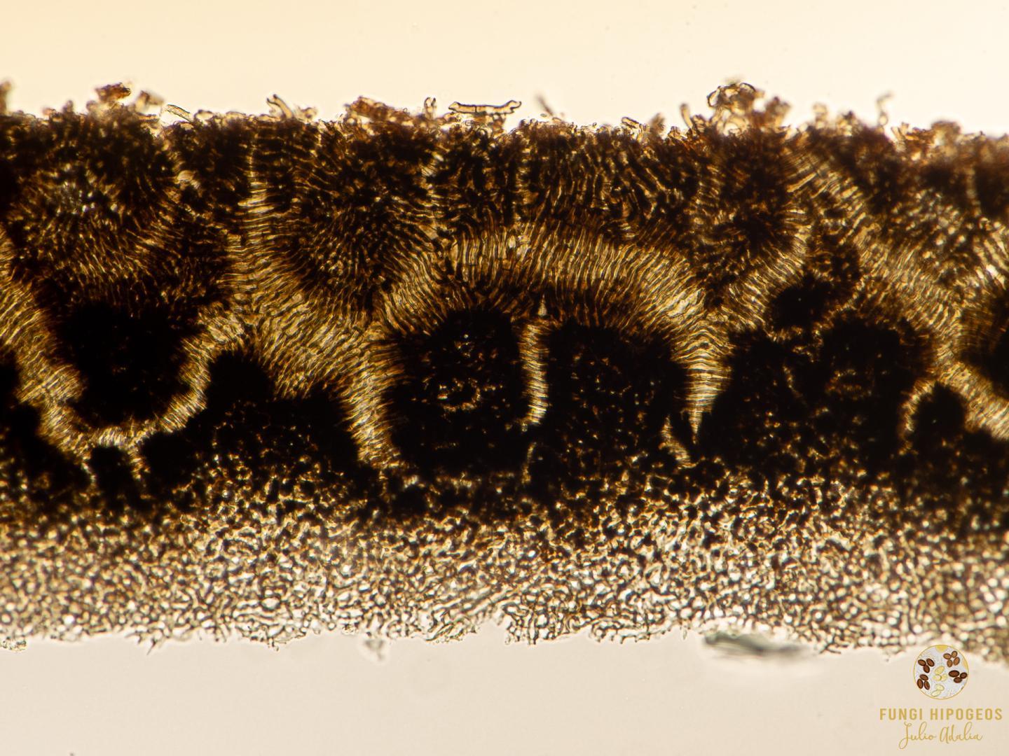 Aspecto del exocortex 