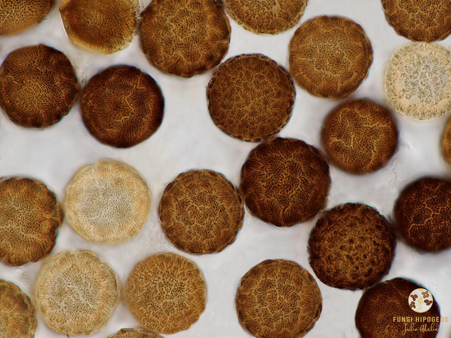 Ascosporas globosas maduras 