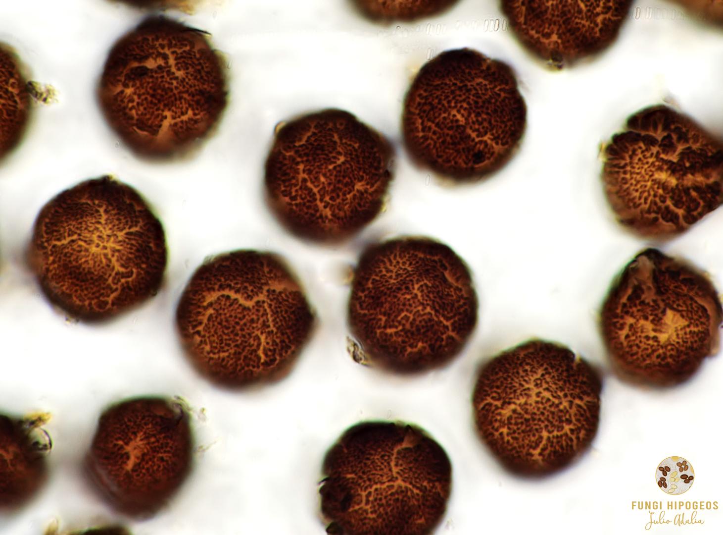 Detalle de la ornamentaci&oacute;n de las ascosoras  