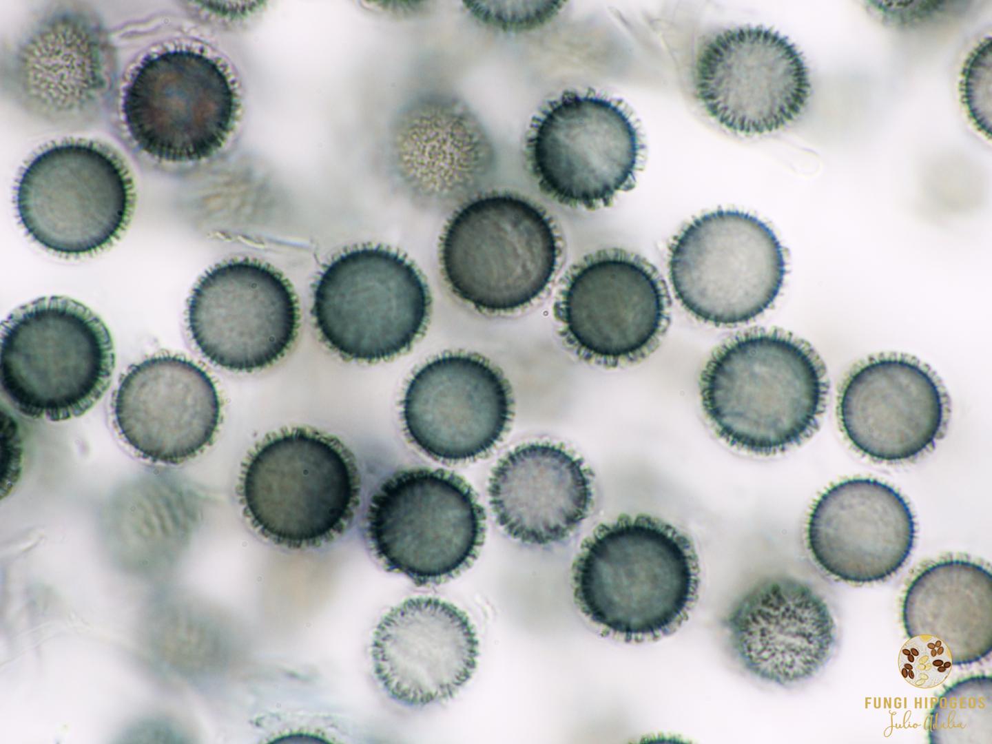 Ascosporas esfericas y aculeadas 