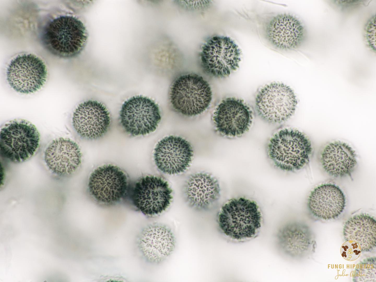 Detalle de la ornamentaci&oacute;n de las ascosporas 