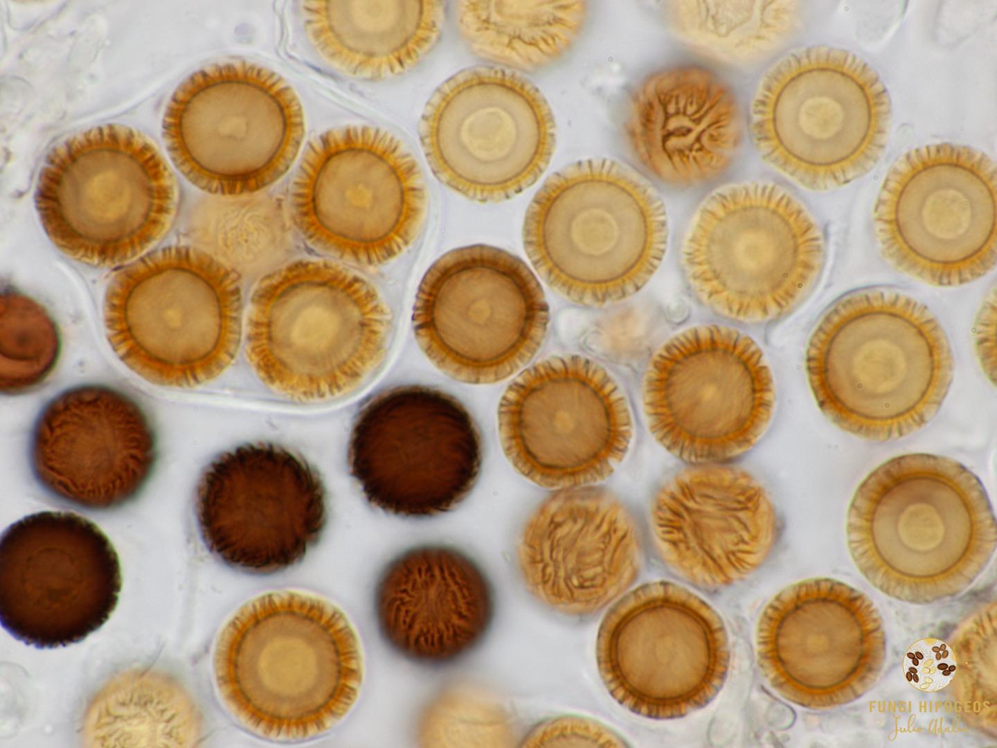 Asco globoso con 5 ascosporas (5)