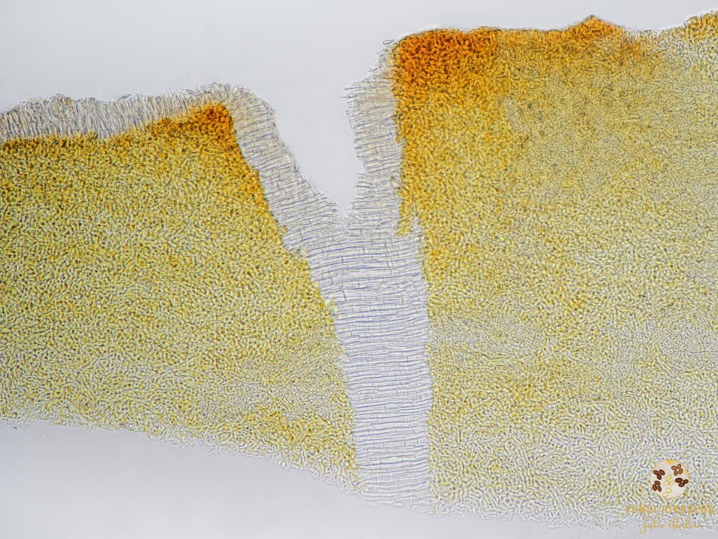 Detalle del exocortex (3)