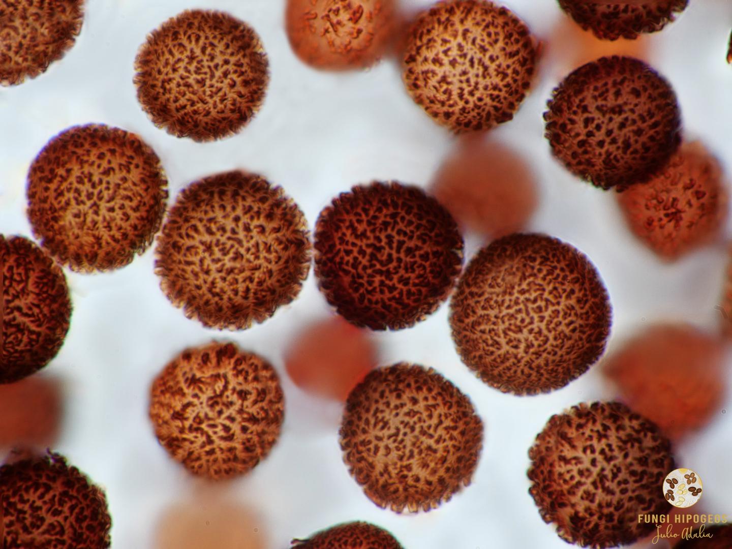 Ascosporas globosas (4)