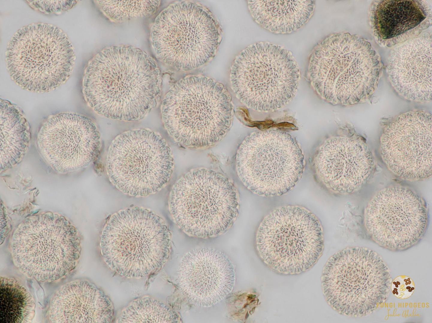 Asc&oacute;sporas esf&eacute;ricas, subhialinas (3).